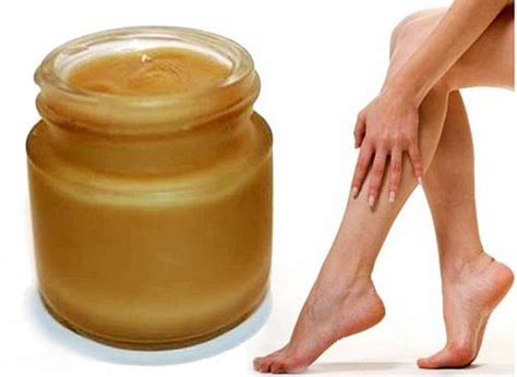 лечение на кожата на краката при разширени вени